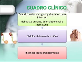 Cuando producían signos y síntomas como
infección
del tracto urinario, dolor abdominal o
hematuria
El dolor abdominal en niños
diagnosticados prenatalmente
 