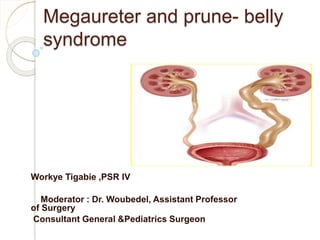 Megaureter and prune- belly
syndrome
Workye Tigabie ,PSR IV
Moderator : Dr. Woubedel, Assistant Professor
of Surgery
Consultant General &Pediatrics Surgeon
 