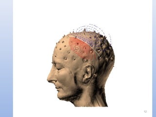 MEG “without” skull 12
 