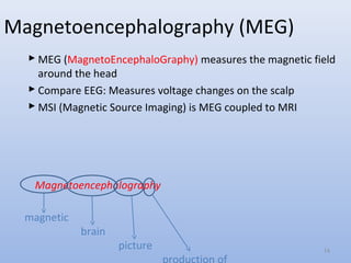 Magnetoencephalography (MEG)
 MEG (MagnetoEncephaloGraphy) measures the magnetic field
around the head
 Compare EEG: Measures voltage changes on the scalp
 MSI (Magnetic Source Imaging) is MEG coupled to MRI
Magnetoencephalography
magnetic
brain
picture 14
 
