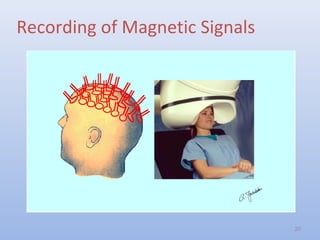 Recording of Magnetic Signals
20
 