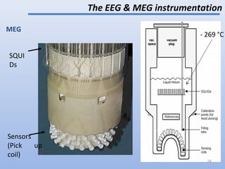 The EEG & MEG instrumentation
Sensors
(Pick up
coil)
SQUI
Ds
MEG
- 269 °C
24
 