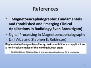 References
• Magnetoencephalography: Fundamentals
and Established and Emerging Clinical
Applications in Radiology(Sven Braeutigam)
• Signal Processing in Magnetoencephalography
(Jiri Vrba and Stephen E. Robinson)
73
 