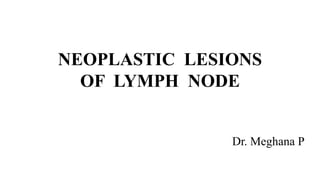 NEOPLASTIC LESIONS
OF LYMPH NODE
Dr. Meghana P
 