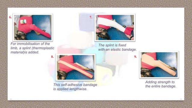 BANDAGING TECHNIQUES | PPTX