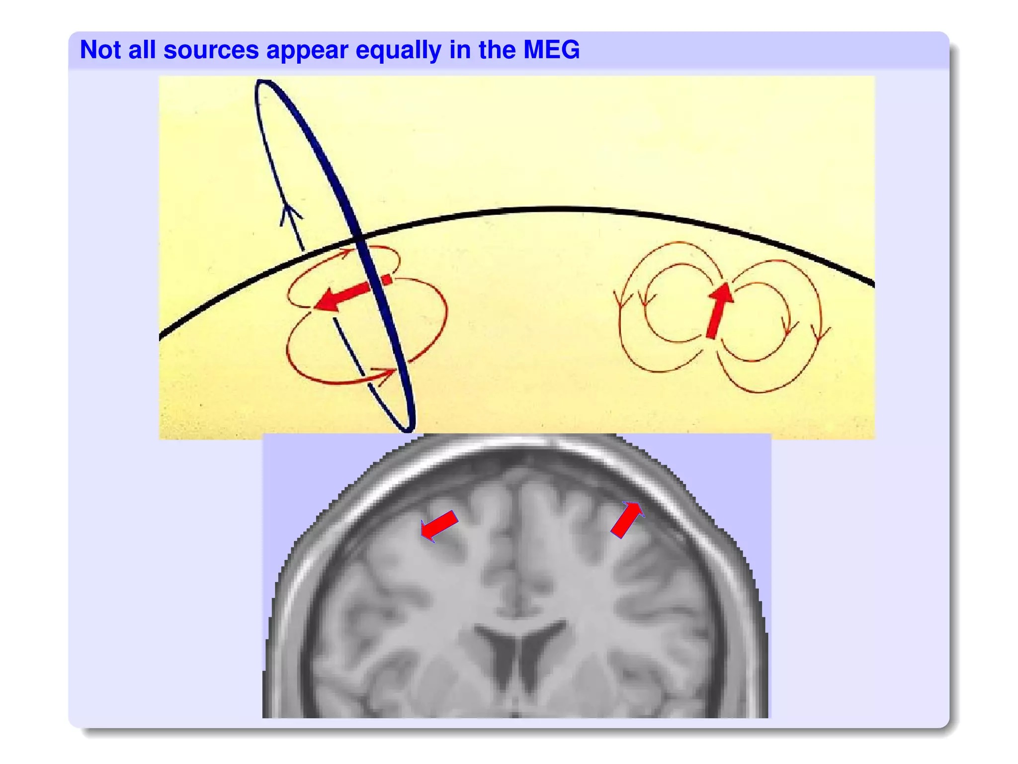 MEG recording of brain signals | PDF