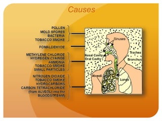 Causes
 