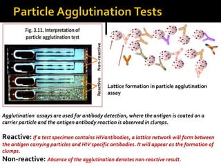 Lattice formation in particle agglutination
assay
Agglutination assays are used for antibody detection, where the antigen is coated on a
carrier particle and the antigen antibody reaction is observed in clumps.
Reactive: If a test specimen contains HIVantibodies, a lattice network will form between
the antigen carrying particles and HIV specific antibodies. It will appear as the formation of
clumps.
Non-reactive: Absence of the agglutination denotes non-reactive result.
 