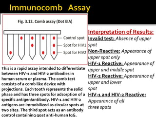 This is a rapid assay intended to differentiate
between HIV-1 and HIV-2 antibodies in
human serum or plasma. The comb test
consists of a comb like device with
projections. Each tooth represents the solid
phase and has three spots for adsorption of a
specific antigen/antibody. HIV-1 and HIV-2
antigens are immobilized as circular spots at
two sites. The third spot acts as an antibody
control containing goat anti-human IgG.
Interpretation of Results:
Invalid test: Absence of upper
spot
Non-Reactive: Appearance of
upper spot only
HIV-1 Reactive: Appearance of
upper and middle spot
HIV-2 Reactive: Appearance of
upper and lower
spot
HIV-1 and HIV-2 Reactive:
Appearance of all
three spots
 