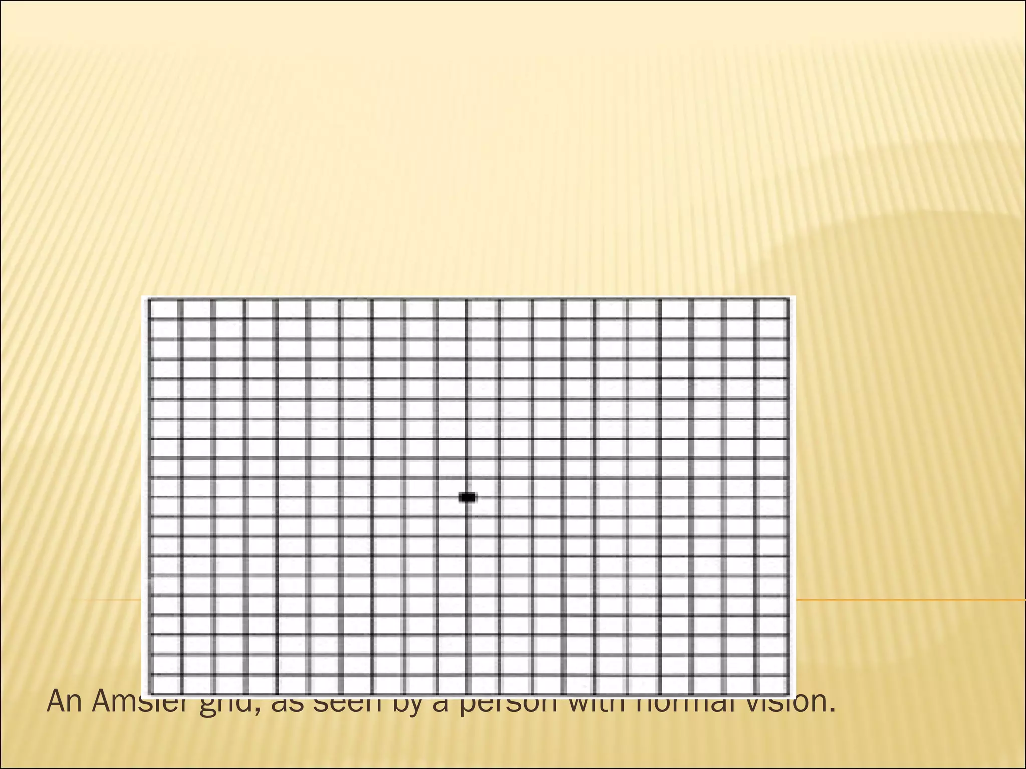 An Amsler grid, as seen by a person with normal vision.
 