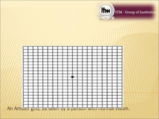 An Amsler grid, as seen by a person with normal vision.
 