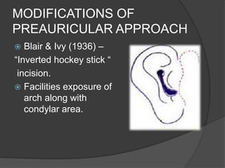 Preauricular Incision Steps Anatomy of Temporomandibular Joint | PPSX