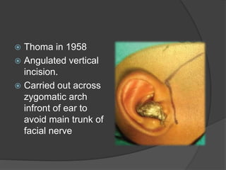 Anatomy of Temporomandibular Joint | PPSX