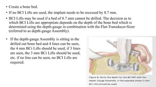 • Create a bone bed.
• If no BCI Lifts are used, the implant needs to be recessed by 8.7 mm.
• BCI Lifts may be used if a bed of 8.7 mm cannot be drilled. The decision as to
which BCI Lifts are appropriate depends on the depth of the bone bed which is
determined using the depth-gauge in combination with the Flat-Transducer-Sizer
(referred to as depth-gauge Assembly).
• If the depth-gauge Assembly is sitting in the
drilled out bone bed and 4 lines can be seen,
the 4 mm BCi Lifts should be used, if 3 lines
are seen, the 3 mm BCi Lifts should be used,
etc. if no line can be seen, no BCI Lifts are
required.
 