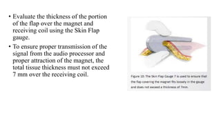 • Evaluate the thickness of the portion
of the flap over the magnet and
receiving coil using the Skin Flap
gauge.
• To ensure proper transmission of the
signal from the audio processor and
proper attraction of the magnet, the
total tissue thickness must not exceed
7 mm over the receiving coil.
 