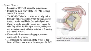 • Step 6: Closure
• Inspect the BC-FMT under the microscope.
• Palpate the main body of the BC-FMT to make
certain it is secure.
• The BC-FMT should be installed solidly and free
from any minor slackness when palpated. ensure
that the receiver coil is in the desired position.
• Close the scalp wound in layers, then suture the
skin flap with a double layer closure, taking care
not to make contact with the installed BCI during
the closure process.
• Clean the incision area and apply a pressure
dressing to the wound.
• To smoothen the transition of the wings to the
bone, add bone pate around the wings of the BCI.
 