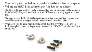 • When drilling the bone bed, the sigmoid sinus and/or the dura might appear.
• With the use of BCI Lifts, compression of the dura can be avoided.
• The BCI Lifts are custom-made washers that can be attached to the wings of
the BC-FMT. They are available in four different sizes, ranging from 1 to 4
mm.
• The appropriate BCI Lift is then pushed onto the wings of the implant and
screwed down with longer screws that come with the BCI Lifts.
• When using Lifts, care must be taken that the skin over the BCI Lifts is
thick enough to cover the higher elevation of the BC-FMT together with the
BCI Lifts.
 
