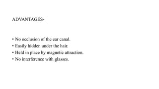 ADVANTAGES-
• No occlusion of the ear canal.
• Easily hidden under the hair.
• Held in place by magnetic attraction.
• No interference with glasses.
 