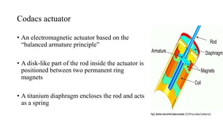 Codacs actuator
• An electromagnetic actuator based on the
“balanced armature principle”
• A disk-like part of the rod inside the actuator is
positioned between two permanent ring
magnets
• A titanium diaphragm encloses the rod and acts
as a spring
 