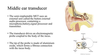 Middle ear transducer
• The semi-implantable MET uses an
external unit called the button external
audio processor, containing a
microphone,battery,signal processor and
transmitter.
• The transducer drives an electromagnetic
probe coupled to the body of the incus.
• The tip of the probe is made of aluminium
oxide, which forms a fibrous connection
with the incus body.
 