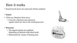 How it works
• Sound travels down ear canal and vibrates eardrum
• Sensor
• Picks up vibrations from incus.
• Converts vibrations into electrical
signals which are sent to the sound processor.
• Processor
• The digital signals are modified
depending on patients individual needs
• Determined by variety of hearing tests
 