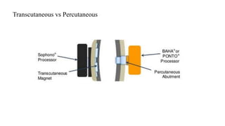 Transcutaneous vs Percutaneous
 