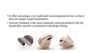 • It offers advantages over traditional osseointegrated devices in that it
does not require surgical placement.
• Acoustic feedback is the most commonly reported problem with the
Sound-Bite, and this is minimized with proper fitting.
 
