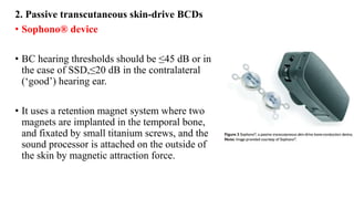 2. Passive transcutaneous skin-drive BCDs
• Sophono® device
• BC hearing thresholds should be ≤45 dB or in
the case of SSD,≤20 dB in the contralateral
(‘good’) hearing ear.
• It uses a retention magnet system where two
magnets are implanted in the temporal bone,
and fixated by small titanium screws, and the
sound processor is attached on the outside of
the skin by magnetic attraction force.
 