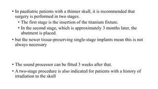 • In paediatric patients with a thinner skull, it is recommended that
surgery is performed in two stages.
• The first stage is the insertion of the titanium fixture.
• In the second stage, which is approximately 3 months later, the
abutment is placed.
• but the newer tissue-preserving single-stage implants mean this is not
always necessary
• The sound processor can be fitted 3 weeks after that.
• A two-stage procedure is also indicated for patients with a history of
irradiation to the skull
 