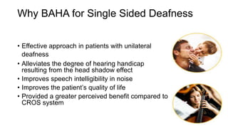 Why BAHA for Single Sided Deafness
• Effective approach in patients with unilateral
deafness
• Alleviates the degree of hearing handicap
resulting from the head shadow effect
• Improves speech intelligibility in noise
• Improves the patient’s quality of life
• Provided a greater perceived benefit compared to
CROS system
 