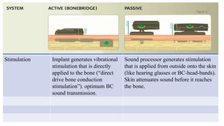 Stimulation Implant generates vibrational
stimulation that is directly
applied to the bone (“direct
drive bone conduction
stimulation”). optimum BC
sound transmission.
Sound processor generates stimulation
that is applied from outside onto the skin
(like hearing glasses or BC-head-bands).
Skin attenuates sound before it reaches
the bone.
 