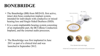 BONEBRIDGE
• The Bonebridge (BB) from MED-EL first active,
intact skin bone conduction implant system,
intended for individuals with conductive or mixed
hearing loss and Single-Sided Deafness (SSD).
• It is a semi-implantable hearing system consisting
of an implantable part, the BCI (Bone Conduction
Implant), and the external audio processor,
• The Bonebridge was first implanted in June
2011 as part of a clinical trial and was
launched in September 2012.
 