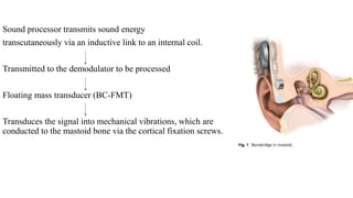 Sound processor transmits sound energy
transcutaneously via an inductive link to an internal coil.
Transmitted to the demodulator to be processed
Floating mass transducer (BC-FMT)
Transduces the signal into mechanical vibrations, which are
conducted to the mastoid bone via the cortical fixation screws.
 