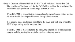 • Step 3: Creation of Bone Bed for BC-FMT And Periosteal Pocket For Coil
• The position of the bone bed for the BC-FMT as well as the position of the
fixation holes depends on the findings of the CT scan.
• If the BC-FMT is placed in the sinodural angle, the reference points are the
spine of Henle, the temporal line and the tip of the mastoid.
• It is usually made as close as possible to the EAC and with one of the BC-
FMT wings sitting on the temporal line.
• If the BC-FMT is placed behind the sinus, the attachment of the digastric
muscle and the mastoid tip are to be used as reference points.
 