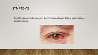 SYMPTOMS
• Symptoms commonly worsen in the morning and patients have exacerbations
and remissions.
 
