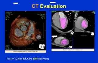 CT Evaluation
Fuster V, Kim RJ, Circ 2005 (In Press)
 
