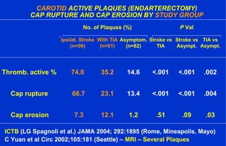 CAROTID ACTIVE PLAQUES (ENDARTERECTOMY)
CAP RUPTURE AND CAP EROSION BY STUDY GROUP
ICTB (LG Spagnoli et al.) JAMA 2004; 292:1895 (Rome, Mineapolis, Mayo)
C Yuan et al Circ 2002;105:181 (Seattle) – MRI – Several Plaques
No. of Plaques (%) P Val
Ipsilat. Stroke With TIA Asymptom. Stroke vs Stroke vs TIA vs
(n=96) (n=91) (n=82) TIA Asympt. Asympt.
Thromb. active % 74.0 35.2 14.6 <.001 <.001 .002
Cap rupture 66.7 23.1 13.4 <.001 <.001 .004
Cap erosion 7.3 12.1 1.2 .51 .09 .03
 