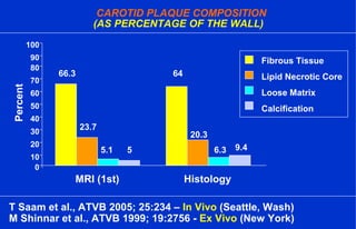 0
10
20
30
40
50
60
70
80
90
100
MRI (1st) Histology
Percent
66.3 64
23.7
5.1 5
20.3
6.3 9.4
CAROTID PLAQUE COMPOSITION
(AS PERCENTAGE OF THE WALL)
Fibrous Tissue
Lipid Necrotic Core
Loose Matrix
Calcification
T Saam et al., ATVB 2005; 25:234 – In Vivo (Seattle, Wash)
M Shinnar et al., ATVB 1999; 19:2756 - Ex Vivo (New York)
 