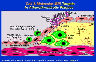 Cell & Molecular MRI Targets
In Atherothrombotic Plaques
Lipinski MJ, Fuster V, Fisher EA, Fayad ZA, Nature Cardiov. Med. 2004;1:1
 