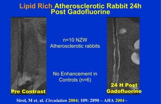 Lipid Rich Atherosclerotic Rabbit 24h
Post Gadofluorine
n=10 NZW
Atherosclerotic rabbits
No Enhancement in
Controls (n=6)
Pre Contrast
24 H Post
Gadofluorine
Sirol, M et. al. Circulation 2004; 109: 2890 – AHA 2004 -
 