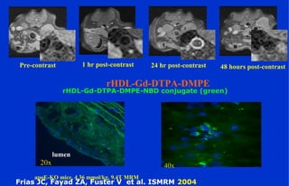 Pre-contrast 48 hours post-contrast1 hr post-contrast 24 hr post-contrast
20x
lumen
wall
40x
Frias JC, Fayad ZA, Fuster V et al. ISMRM 2004
rHDL-Gd-DTPA-DMPE-NBD conjugate (green)
rHDL-Gd-DTPA-DMPE
apoE-KO mice, 4.36 mmol/kg, 9.4T MRM
 
