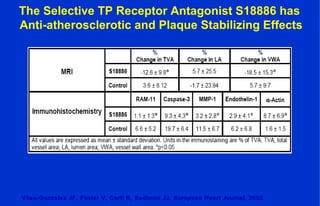 The Selective TP Receptor Antagonist S18886 has
Anti-atherosclerotic and Plaque Stabilizing Effects
Viles-Gonzalez JF, Fuster V, Corti R, Badimon JJ.Viles-Gonzalez JF, Fuster V, Corti R, Badimon JJ. European Heart JournalEuropean Heart Journal, 2005, 2005
 