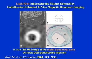 Lipid-Rich Atherosclerotic Plaques Detected by
Gadofluorine-Enhanced In Vivo Magnetic Resonance Imaging
Sirol, M et. al. Circulation 2004; 109: 2890.
In vivo T1W MR image of the rabbit abdominal aorta
24-hours post-gadofluorine injection
 