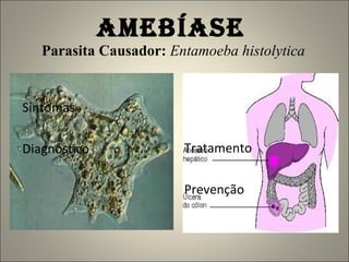 AMEBÍASE   Parasita Causador:  Entamoeba histolytica Sintomas Diagnóstico Tratamento Prevenção 