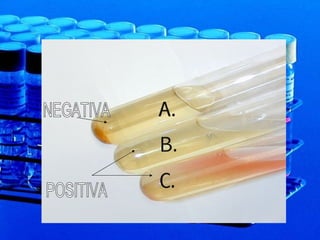 NEGATIVA POSITIVA 