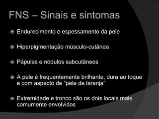 FNS – Sinais e sintomasEndurecimento e espessamento da peleHiperpigmentação músculo-cutâneaPápulas e nódulos subcutâneosA pele é frequentemente brilhante, dura ao toque e com aspecto de “pele de laranja” Extremidade e tronco são os dois locais mais comumente envolvidos 