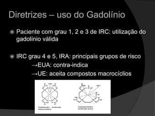 Diretrizes – uso do GadolínioPaciente com grau 1, 2 e 3 de IRC: utilização do gadolínio válidaIRC grau 4 e 5, IRA: principais grupos de risco ->EUA: contra-indica             ->UE: aceita compostos macrocíclios