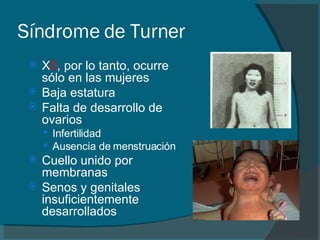 Síndrome de Turner X 0 , por lo tanto, ocurre sólo en las mujeres Baja estatura Falta de desarrollo de ovarios Infertilidad Ausencia de menstruación Cuello unido por membranas Senos y genitales insuficientemente desarrollados 