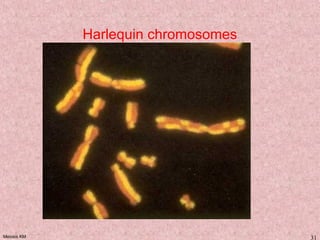 Meiosis KM 31
Harlequin chromosomes
 