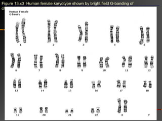 Figure 13.x3 Human female karyotype shown by bright field G-banding of
chromosomes
 